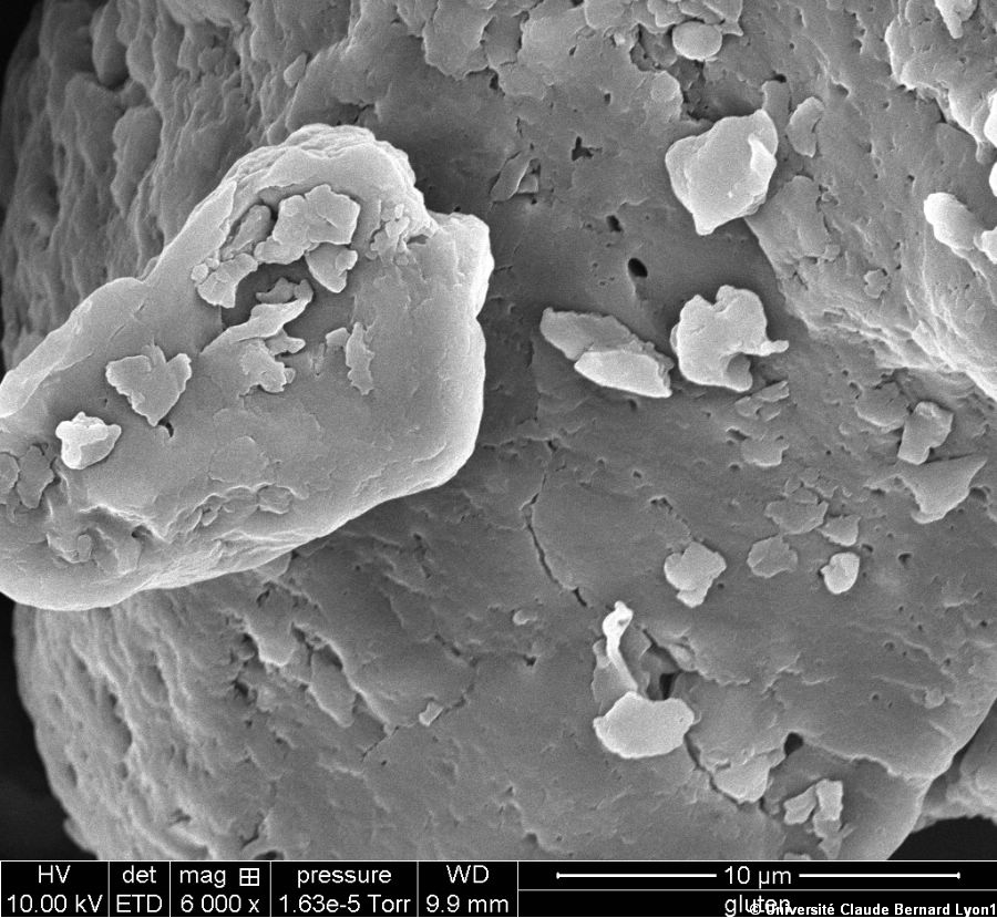 Photothèque Lyon 1 - Image Microscopie Gluten 