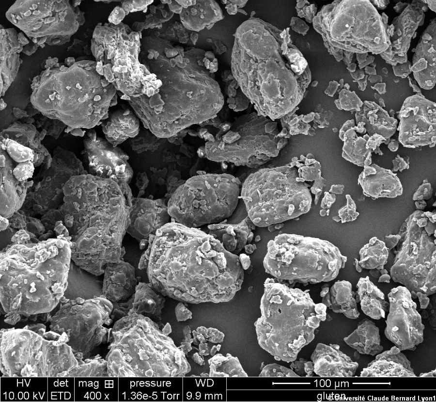 Photothèque Lyon 1 - Image Microscopie Gluten 