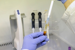 Plateforme Neuro Bio tech Lyon1