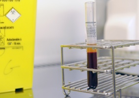 Plateforme Neuro Bio tech Lyon1