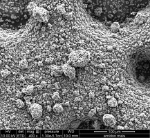 Image Microscopie Gluten