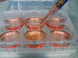 Pipetage
