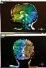 IRM cérébrale colorisée
